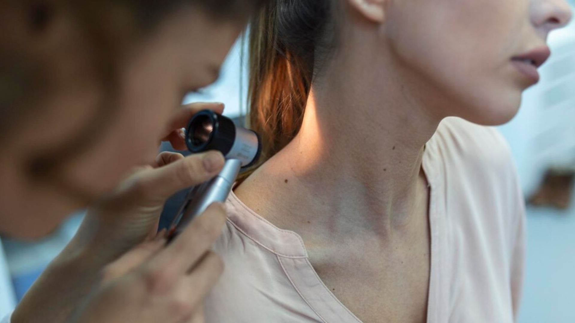How to make moles disappear naturally?