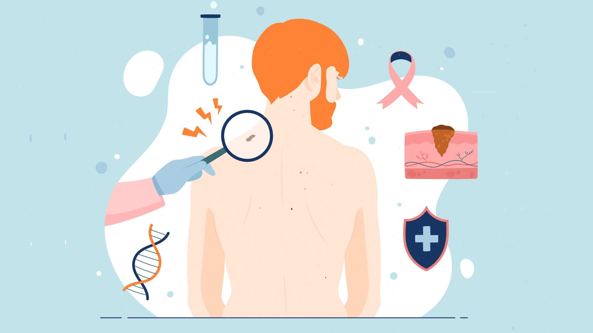 Skin Growths and Skin Cancer