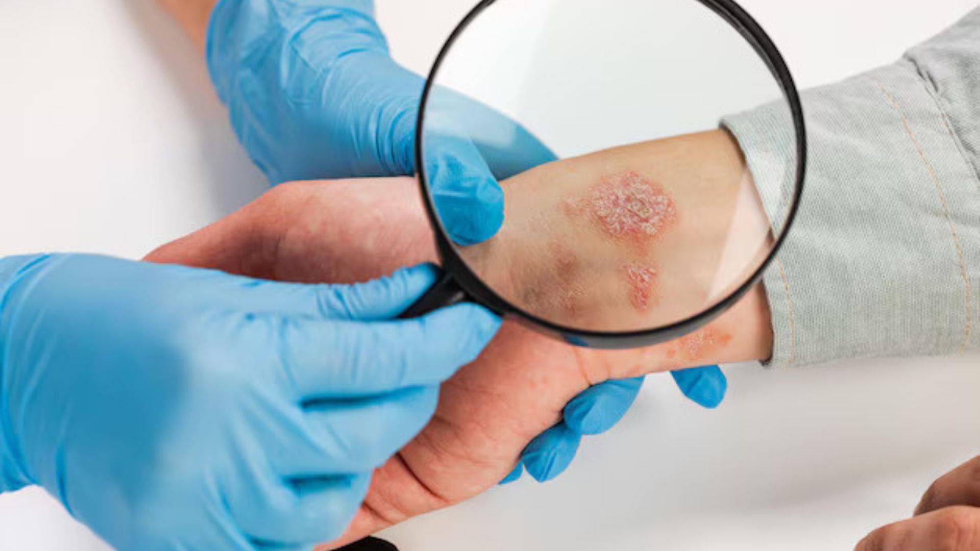 Skin Cancer Detection