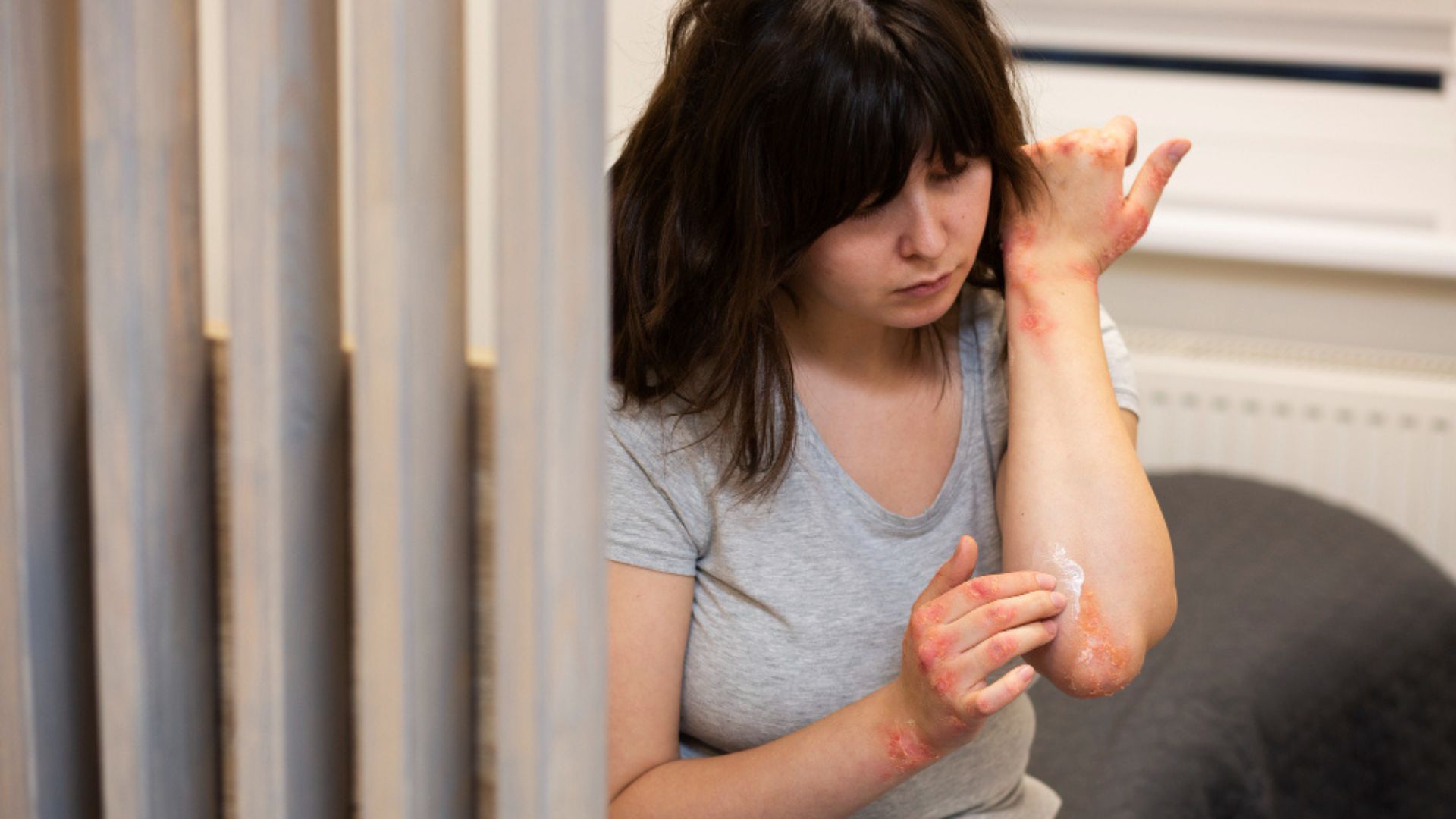 Skin Diseases diagnosis